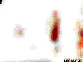 Psycho Doctor Anastasia Rose #2 Slavery Agreement with Balls